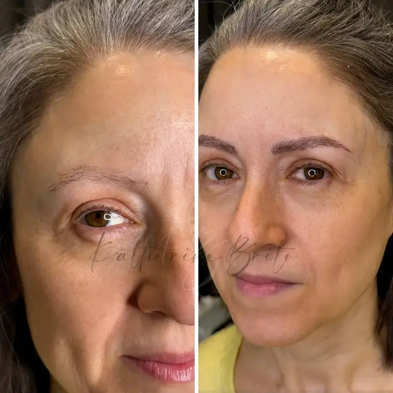 Relleno natural y preciso — Katherine Brito Barcelona